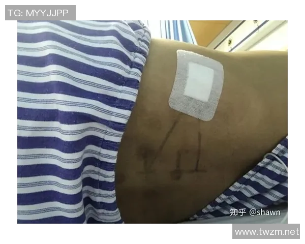 腰椎间盘问题困扰足球明星的职业生涯与康复之路探讨